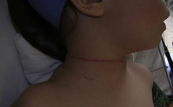 Investigan a madre de una nena de 3 años, que dice la hirió en el cuello con un cuchillo