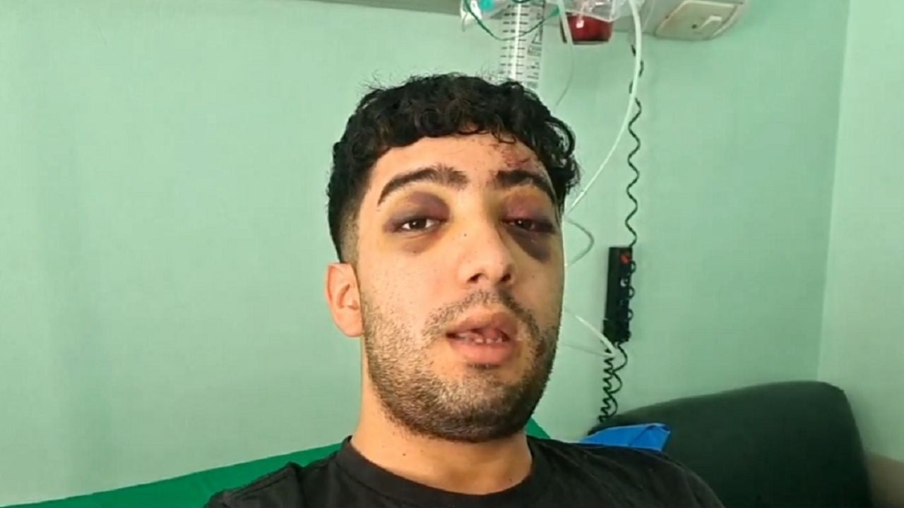 Uso de la Moto Uber: no hay cobertura de seguro