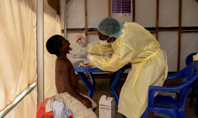 La OMS declaró emergencia sanitaria mundial: qué es la viruela del mono