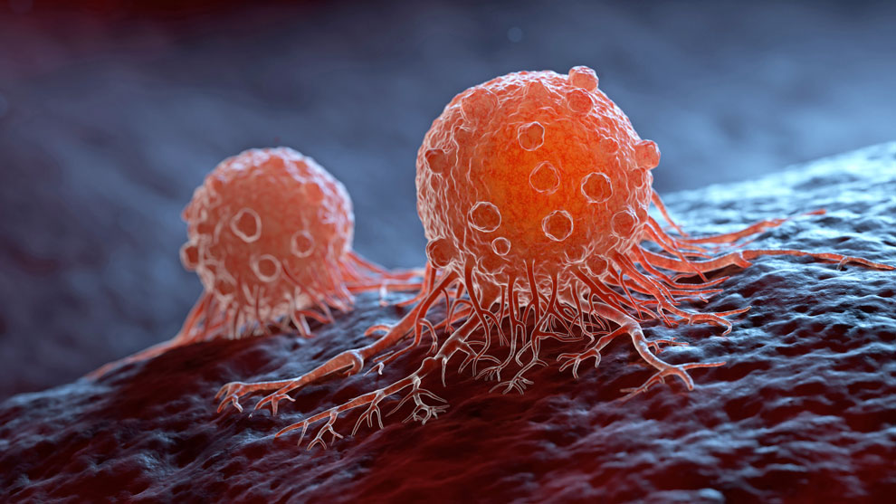 Día mundial de la lucha contra el Cáncer: Se diagnostica un caso canceroso cada 4 minutos en Argentina