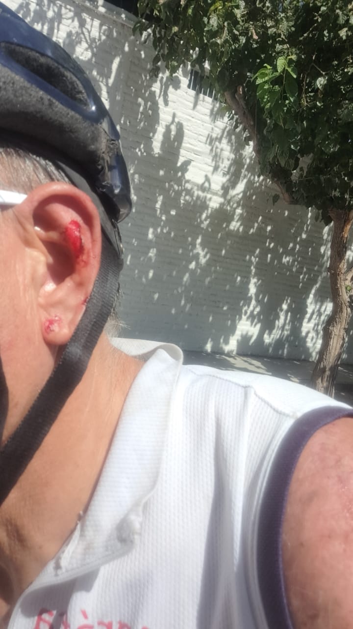 Violencia contra el ex diputado Carlos Perelló: le arrojaron un ladrillazo mientras pedaleaba