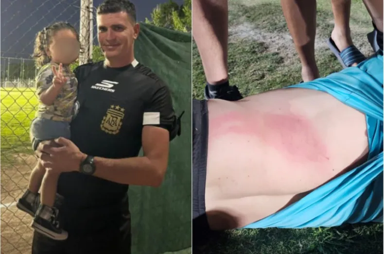 Grave agresión a un árbitro durante un partido de final en la Liga Universitaria en San Juan