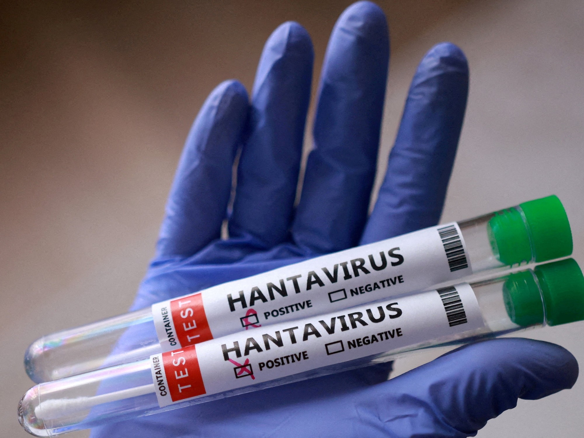 San Juan refuerza controles sanitarios ante el aumento de casos de hantavirus en el país
