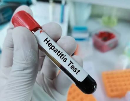 Hepatitis