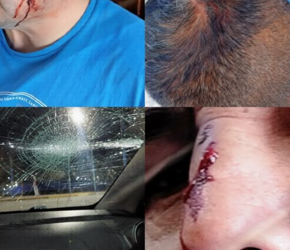 Remisero denunció una brutal golpiza por parte de dos hermanos en Campo Afuera