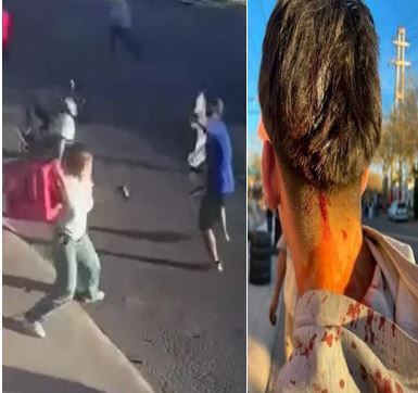 Chimbas: atacaron un kiosco, golpearon a menor y amenazaron con volver