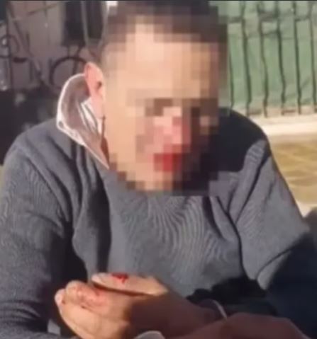 Pocito,chofer agredido por presunto acoso